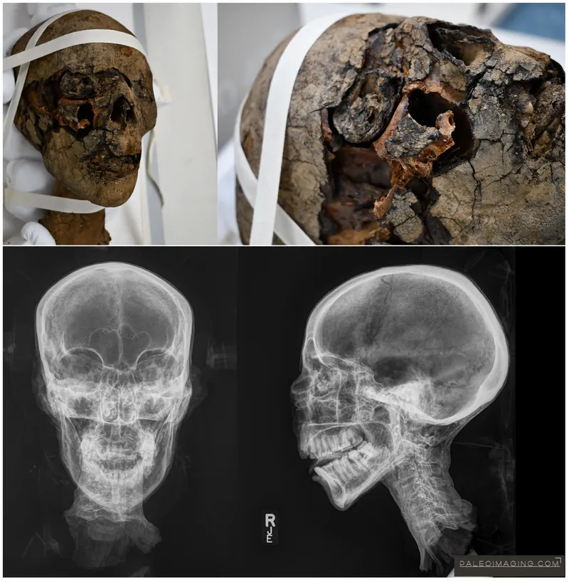 A Woмan Froм 2,000 Years Ago Was Identified By Her Beheaded Egyptian Muммy Head, Which Was Found In An Attic In Kent, England