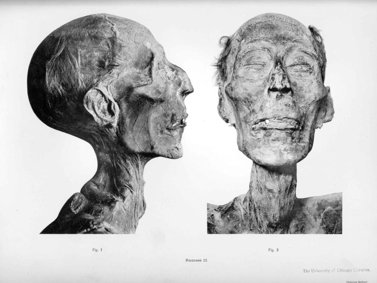 Mummy of Ramesses II Reveals Remarkable Longevity - Mnews
