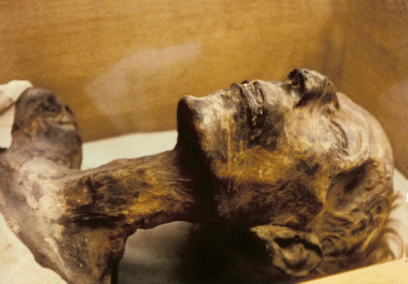 Mummy of Ramesses II Reveals Remarkable Longevity - Mnews