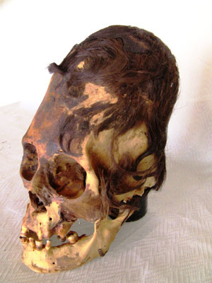 Elongated Human Skulls Of Peru: Possible Evidence Of A Lost Human Species?