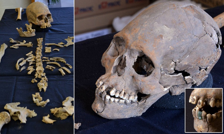 Discover the Secrets of a 1,600-Year-Old Elongated Skull Adorned with Stone-Covered Teeth in Mexico’s Ancient Ruins