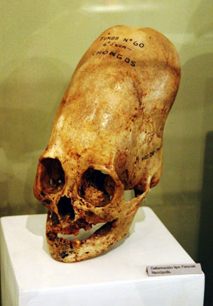 Elongated Human Skulls Of Peru: Possible Evidence Of A Lost Human Species?