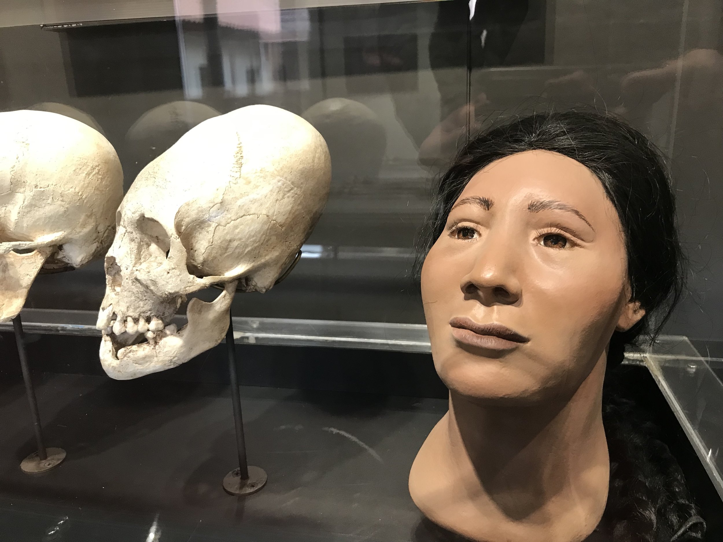 The Mystery of Peru’s Elongated Skulls – Science vs Myth — Louis Wolf