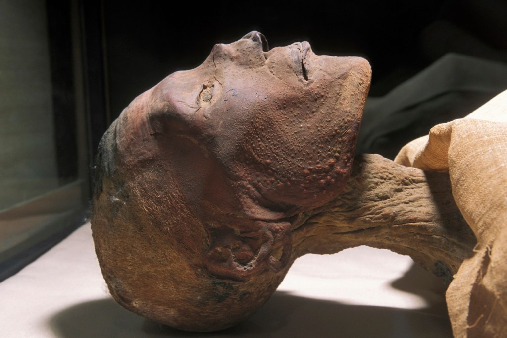 Mummy of King Ramesses V