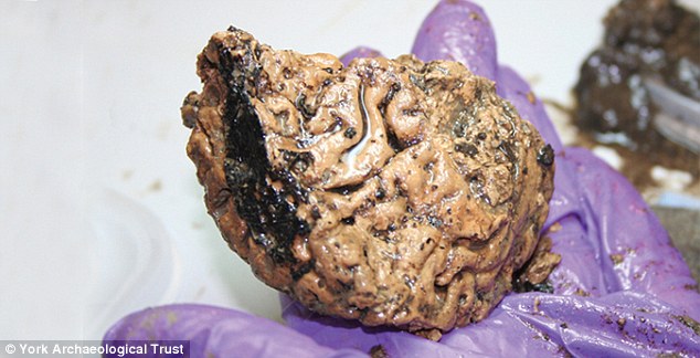 Unlocking Mysteries: 2,600-Year-Old Beheaded Man’s Brain Defies Decay!